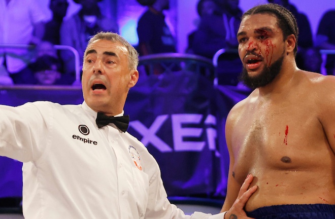 TKV lost his unbeaten record, suffering a gruesome cut from a Macedo right hand Photo Credit: Lawrence Lustig/BOXXER