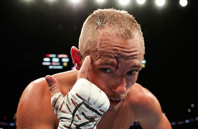 Edwards suffered a gruesome cut in his match against Curiel (Image credit: Amanda Westcott, Matchroom)
